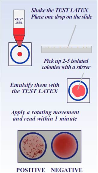comparatif-aureus Comparatif des mérites d'Aureus : avantages et inconvénients