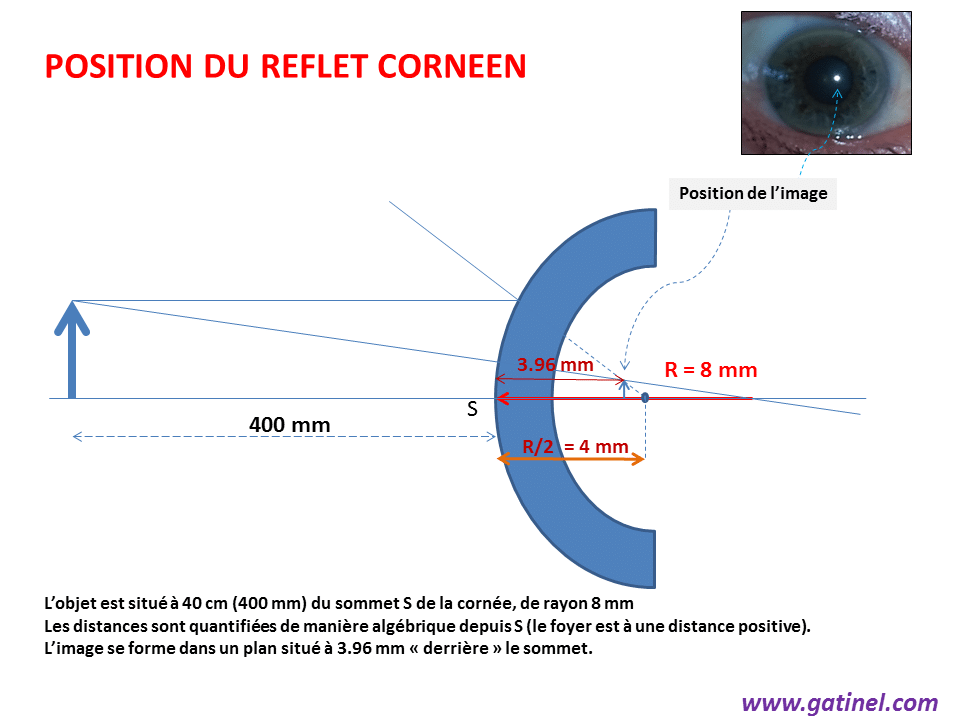 comparatif-methodes-reflexion-1 Comparatif des méthodes de réflexion : laquelle choisir ?
